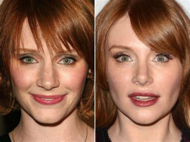 Bryce Dallas Howard before and after plastic surgery 15 Celebrity plastic surgery online