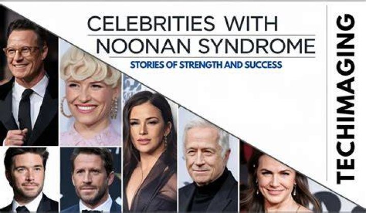 Celebrities with Noonan Syndrome