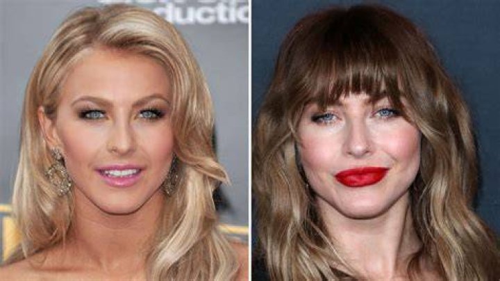 Julianne Hough Plastic Surgery Her Stunning Transformation From Then