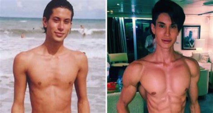 Justin Jedlica Before And After Telegraph