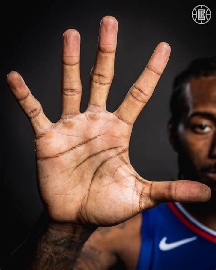 Kawhi Leonard&rsquo;s Hands r/BeAmazed