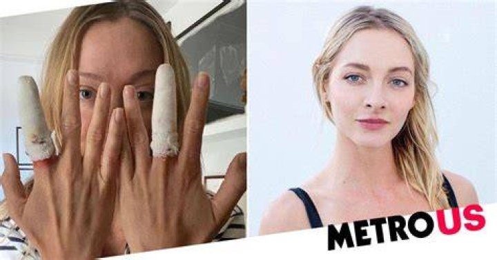 Model is left bloodied after she is beaten up and has her head smashed