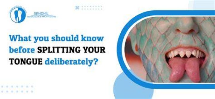 My healed tongue split! I got it back in August and love it 👅👅👅 had no