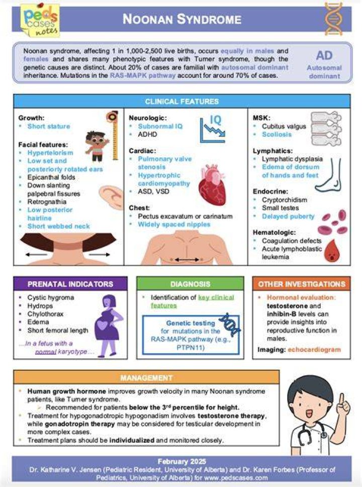 Noonan Syndrome 20 Facts You Didn't Know Discover Walks Blog